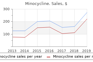 order 50 mg minocycline free shipping