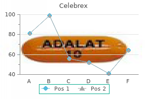 buy 100 mg celebrex with mastercard