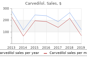 order 25mg carvedilol with amex