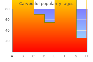 cheap carvedilol 25mg online