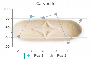 order 25 mg carvedilol amex