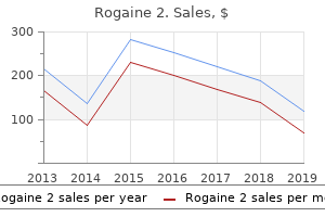 60ml rogaine 2 overnight delivery