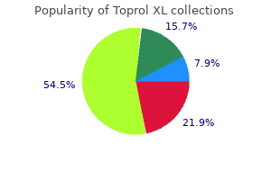 generic toprol xl 50mg free shipping