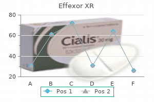 buy effexor xr 75mg mastercard