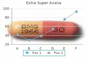 purchase extra super avana 260 mg fast delivery
